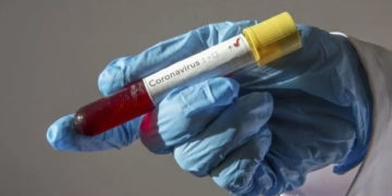 COVID-19: Morocco to Perform 10,000 Screening Tests Per Day