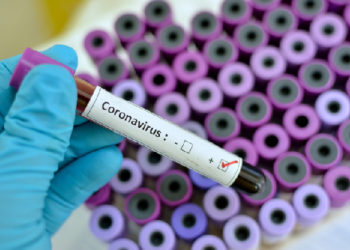 Coronavirus cases rise to 11 in Ghana