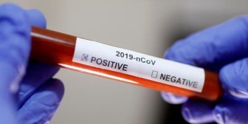 Egypt records 41 new coronavirus cases, 6 deaths