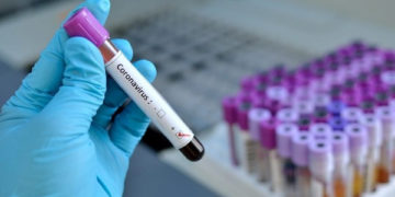 Ghana: 11 more covid-19 cases recorded, case count now 152