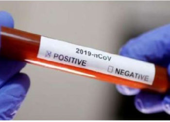 More coronavirus cases recorded, numbers now at 161