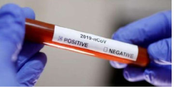 More coronavirus cases recorded, numbers now at 161