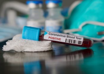 Zimbabwe Confirmed Coronavirus Cases Rise To Five – Health Ministry