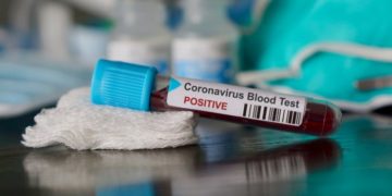Zimbabwe Confirmed Coronavirus Cases Rise To Five – Health Ministry