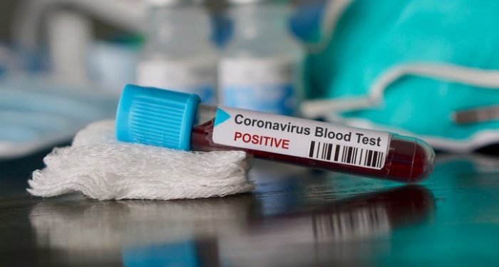 Zimbabwe Confirmed Coronavirus Cases Rise To Five – Health Ministry
