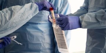 Nigeria: 25-year-old man dies of COVID-19 in Lagos