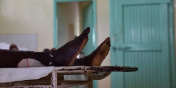 Ghana: Coronavirus kills 19-year-old boy at Walewale