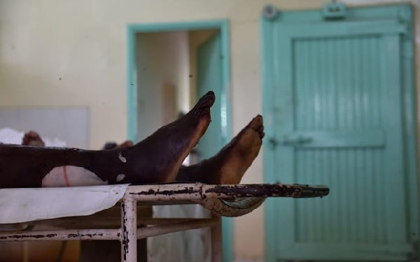 Ghana: Coronavirus kills 19-year-old boy at Walewale