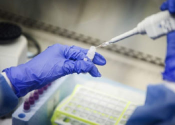 Ghana records 403 new cases of Coronavirus, tally now 2074