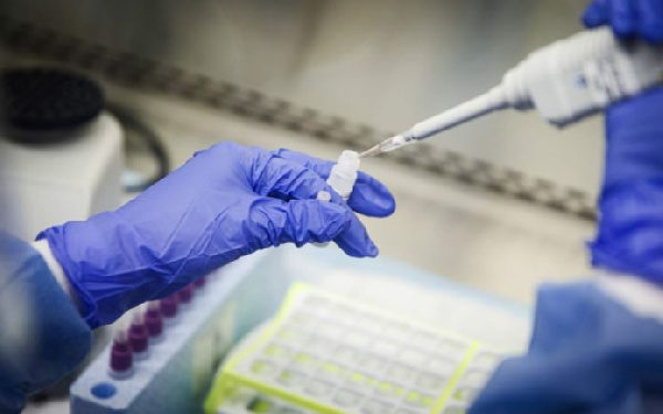 Ghana records 403 new cases of Coronavirus, tally now 2074