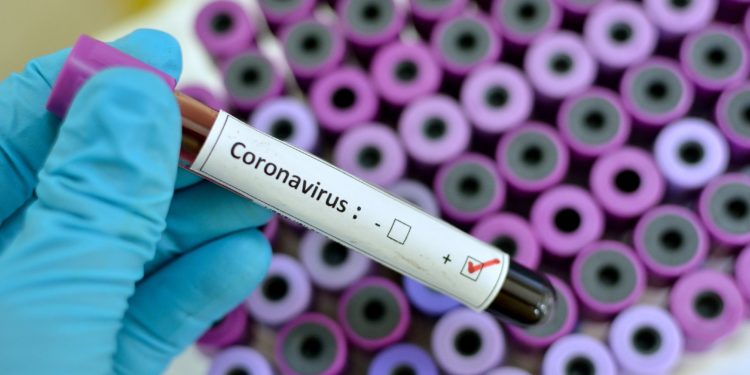 Coronavirus: Lagos Hospital warns visitors to isolate as staff tests positive