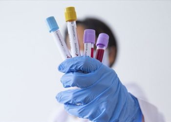 Morocco Reports 64 New COVID-19 Cases, 10 Fatalities in 24 Hours