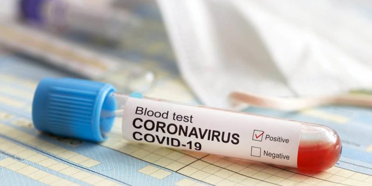 South Africa: Gauteng reports 350 coronavirus recoveries