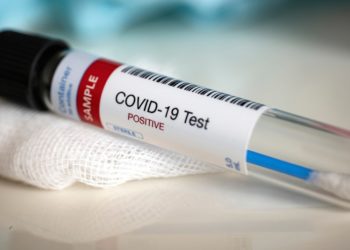 Uganda's virus cases rise to 45 as 301 test negative
