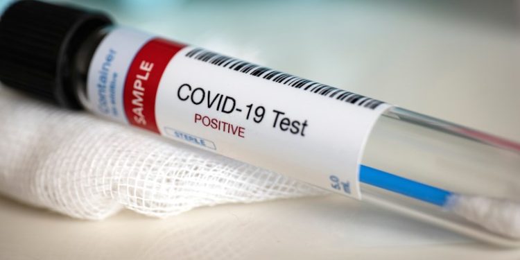 Uganda's virus cases rise to 45 as 301 test negative