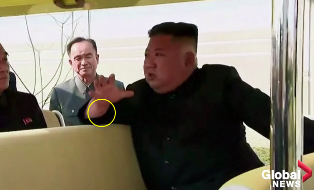 North Korea: Kim Jong Un resurfaces on state media with mysterious mark on wrist