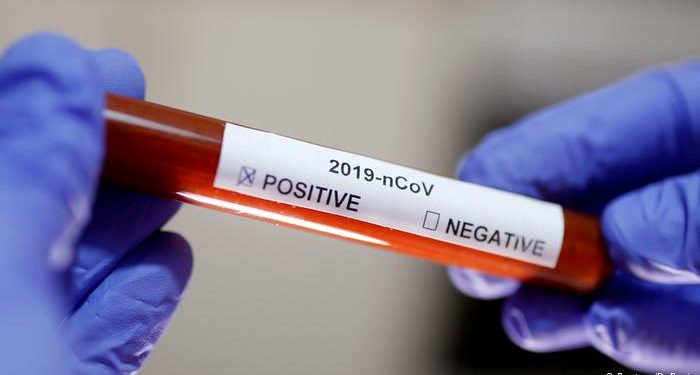 Ghana COVID-19: Ghana's case count hits 6,269, recoveries now 1,898