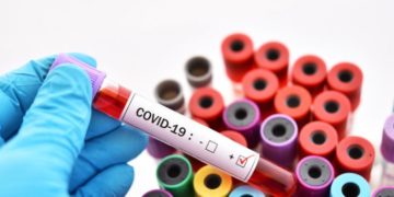 COVID 19: Positive cases in Equatorial Guinea rise to 960, Madagascar gets 405