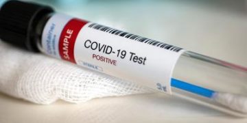 Equatorial Guinea COVID-19: Cases rise to 903, 10 deaths -- WHO