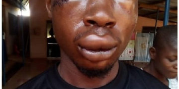 GHANA: CID man brutalizes student for chasing his wife