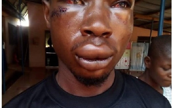 GHANA: CID man brutalizes student for chasing his wife