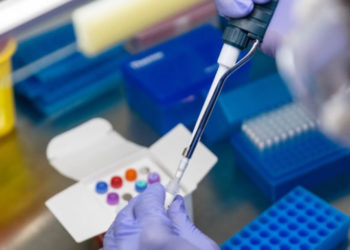 Nigeria: Lagos begins Covid-19 chloroquine clinical trial this week