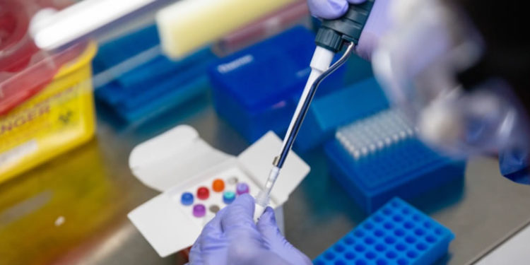 Nigeria: Lagos begins Covid-19 chloroquine clinical trial this week