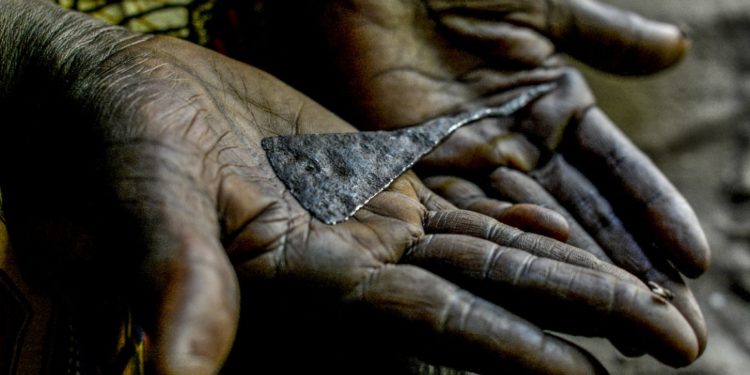 FGM: Female genital mutilation has been documented in 30 countries, mainly in Africa, as well as in the Middle East and Asia.