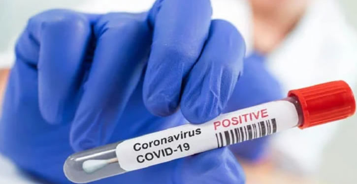 Uganda Covid-19 cases rise to 122