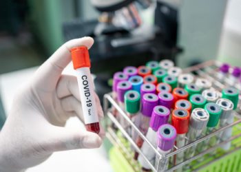 South Sudan confirms 10 new confirmed cases of COVID-19 as total rises to 45