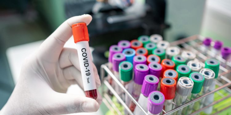 South Sudan confirms 10 new confirmed cases of COVID-19 as total rises to 45