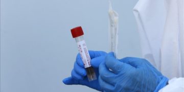 Port Louis: Mauritius records 2 virus cases in nearly 1 month