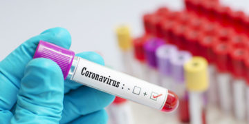 SARS antibodies can prevent Covid-19 infection, new study finds