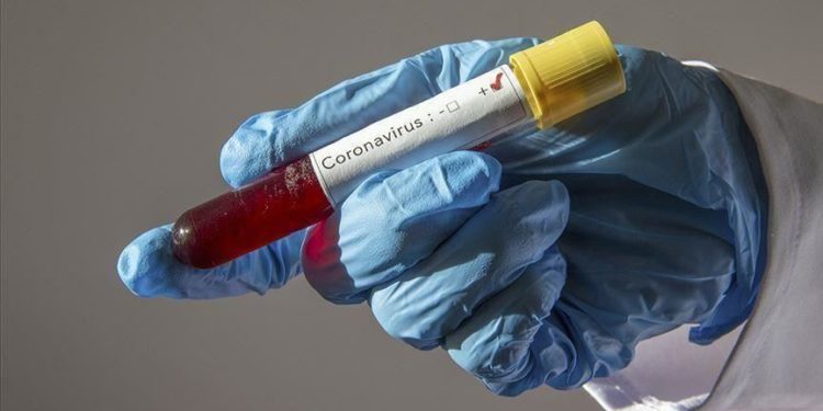 ‘Why Nigeria is recording more COVID-19 cases, deaths’
