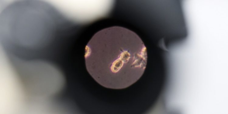 Moscow: 50 Russian military volunteers to test homegrown Covid-19 vaccine