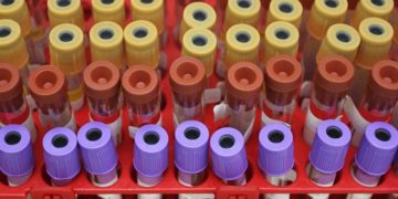 Africa's confirmed COVID-19 cases top 230,000: Africa CDC