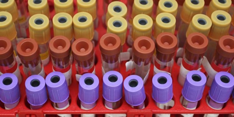 Africa's confirmed COVID-19 cases top 230,000: Africa CDC