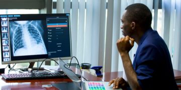 Kigali: Rwandan startup using artificial intelligence to scale up Covid-19 testing