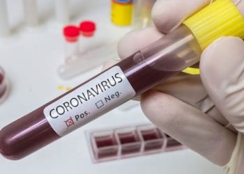 BREAKING: 556 new COVID-19 cases take Nigeria’s total to 36,663; death toll now 789