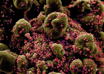 More contagious British Covid-19 variant has ‘significantly higher mortality rate’ than other strains, says UK study