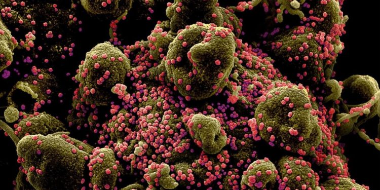 More contagious British Covid-19 variant has ‘significantly higher mortality rate’ than other strains, says UK study