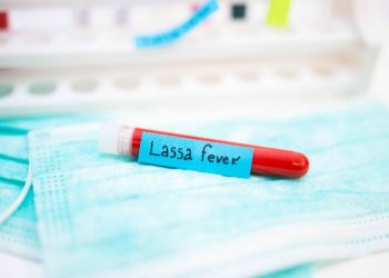 ABUJA: Lassa fever kills 80 in Nigeria: official