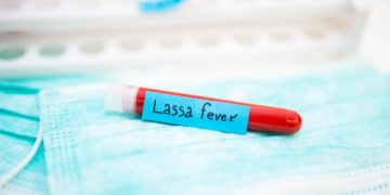 ABUJA: Lassa fever kills 80 in Nigeria: official