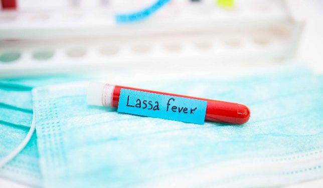 ABUJA: Lassa fever kills 80 in Nigeria: official