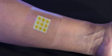 Tech: Smart plaster that tracks status of infections in wounds