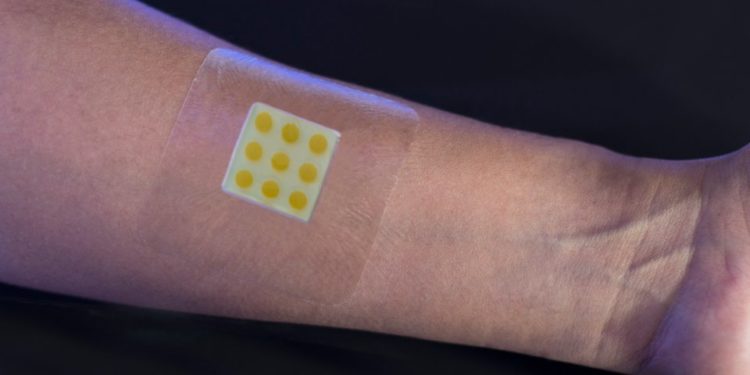 Tech: Smart plaster that tracks status of infections in wounds