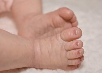 One-day-old baby undergoes successful cardiac catheterization in Egypt’s Port Said