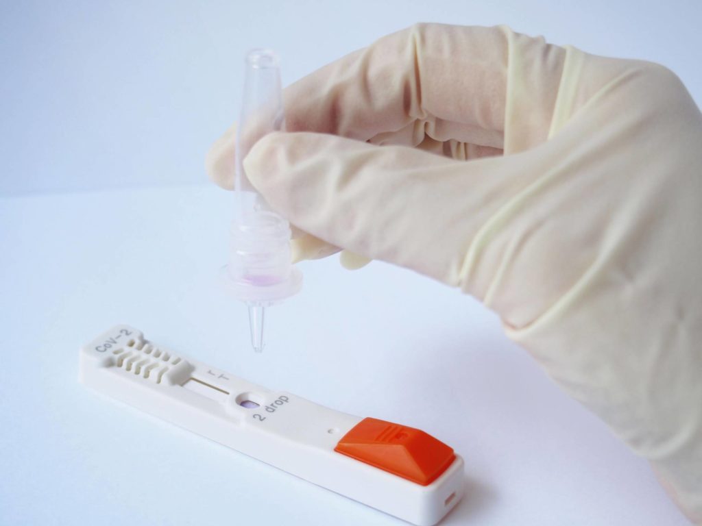 Inadequate testing frustrate Nigeria’s effort to curb COVID-19