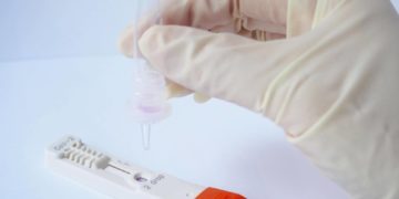 Inadequate testing frustrate Nigeria’s effort to curb COVID-19