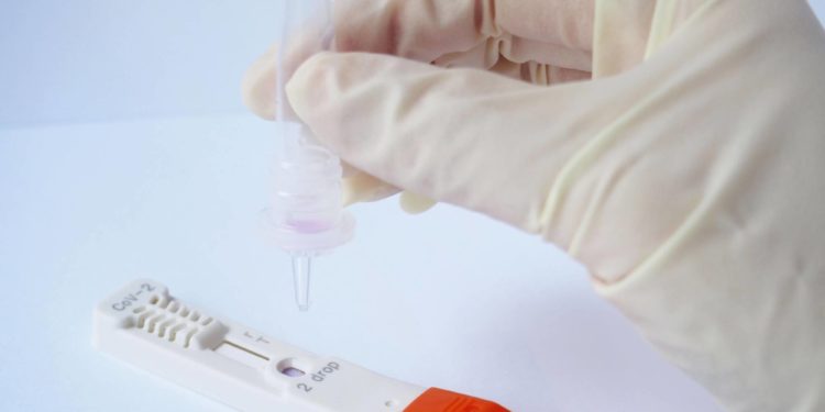 Inadequate testing frustrate Nigeria’s effort to curb COVID-19